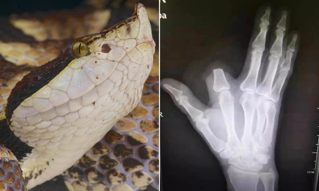 Se amputó su propio dedo después de que una serpiente venenosa lo mordiera, en el hospital le dijeron que fue innecesario image 20424634 0 image a 6 1572525288483