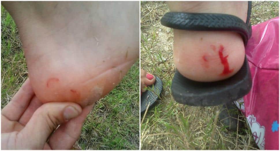 Veinte personas heridas por ataques de peces palometas en balnearios de Santa Fe (Argentina) image 625845 20150204170733