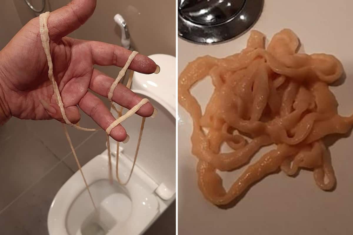 Thai-man-horrified-after-pulling-a-giant-moving-tapeworm-out