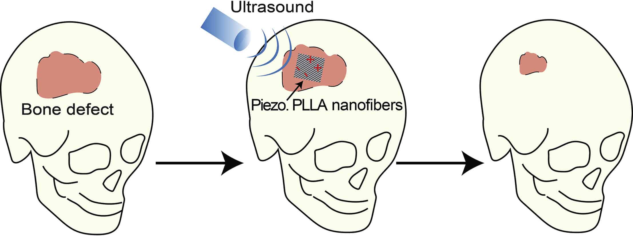 Graphical Abstract