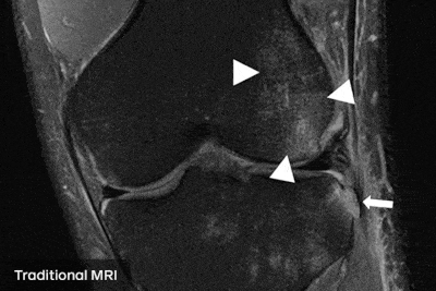 resonancias magneticas Facebook desarolla una inteligencia artificial que hace las resonancias magnéticas 4 veces más rápido resonancias magnéticas tradicionales