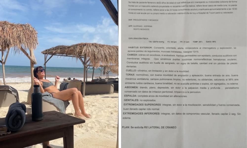 Turista argentina sufrió un grave accidente en Tulum y piden ayuda para saldar los gastos de internación (1)