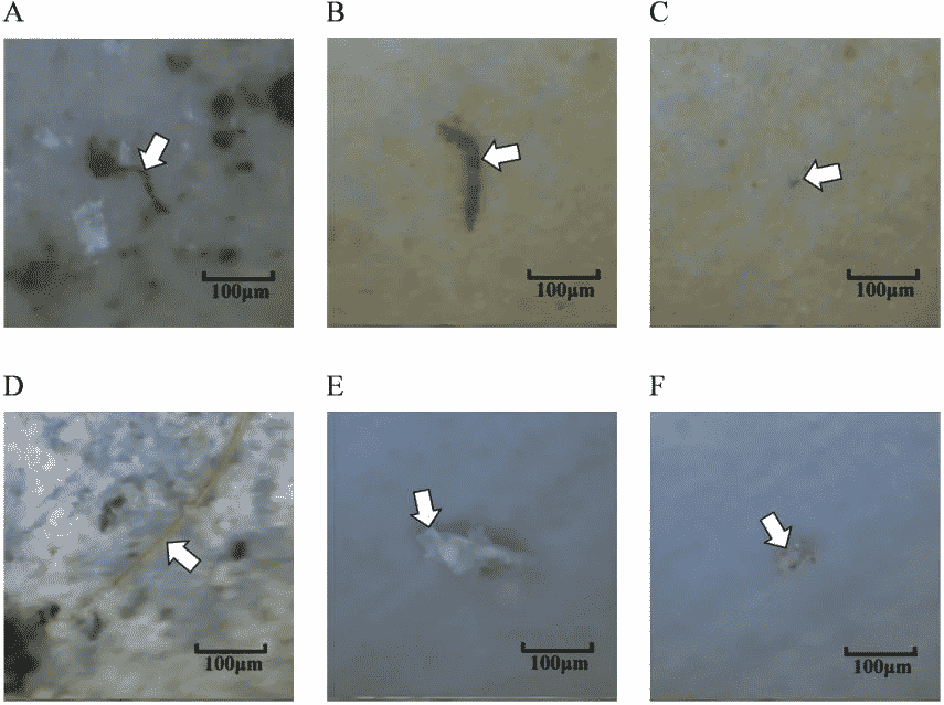 image microplásticos microplasticos pulmones 2668221