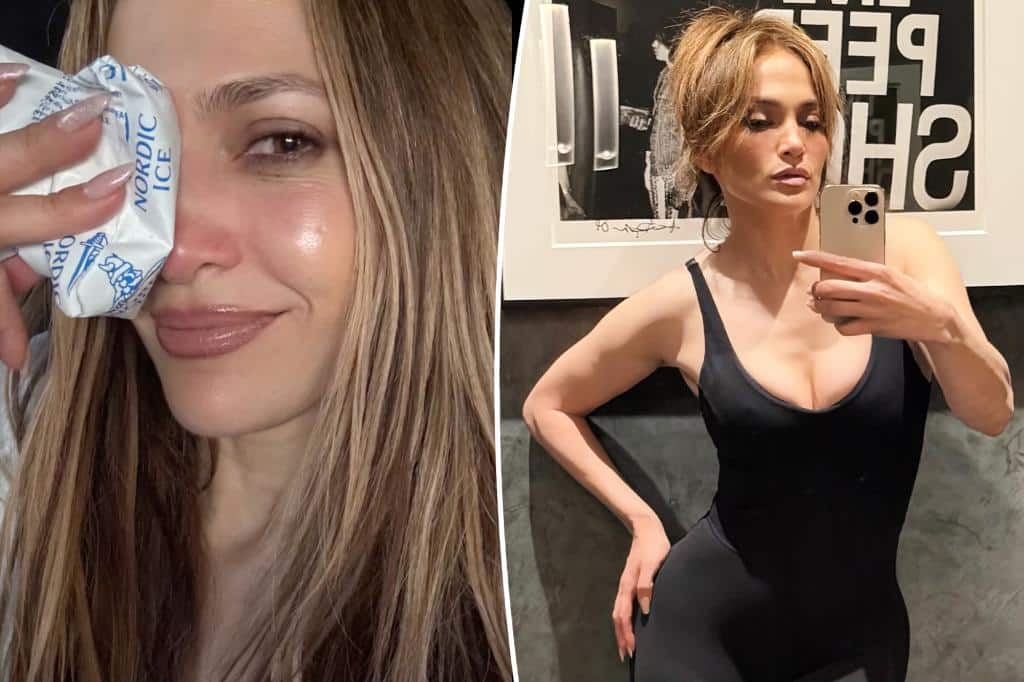 Jennifer-Lopez-sufre-grave-lesion-facial-durante-ensayo-para-2025-intriper.jpg