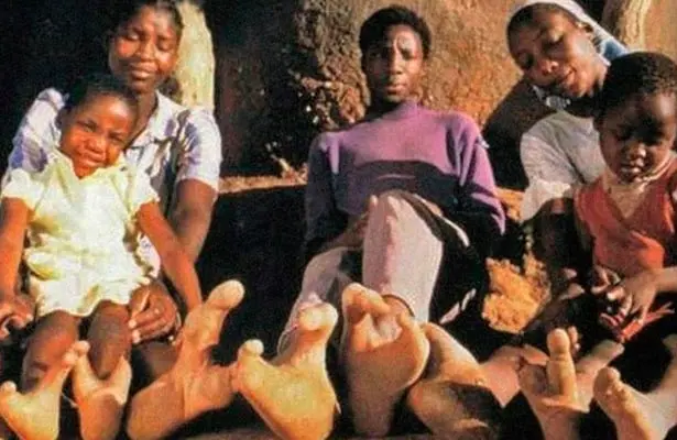 image Noticia 20210322 Oldies PiesDeAvestruz2