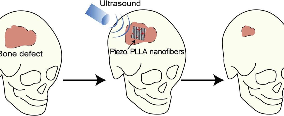 Graphical Abstract