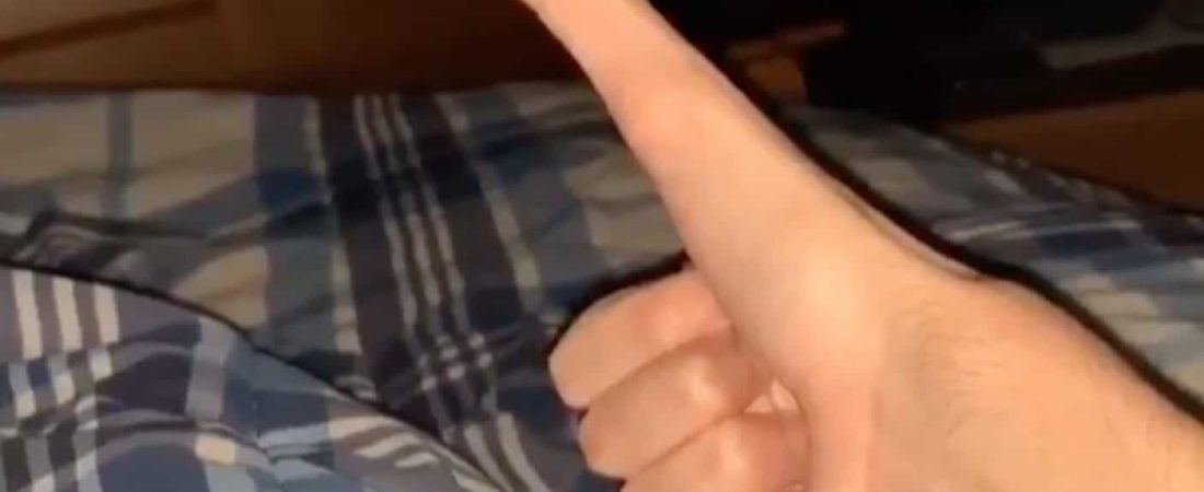 Pic By CATERS NEWS  (PICTURED: Jacob Pina, showing his thumb.) - In an anatomical anomaly this man has been blessed with a thumb that measures five inches long. College student, Jacob Pina from West Port, Massachusetts, has been having fun on social media in sharing his lengthy thumb. The 20-year-old has no idea why his thumb is largely to of proportion with the rest of his hand but he has embraced and love showing it off. In one of his clips he remarks that he has never lost a thumb war, which is hard to dispute. -  SEE CATERS COPY