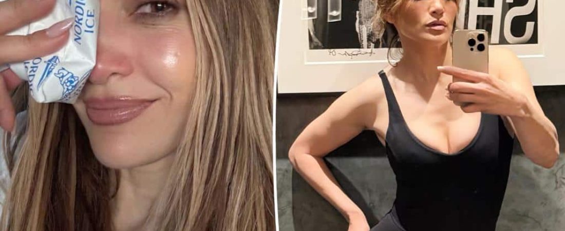 Jennifer-Lopez-sufre-grave-lesion-facial-durante-ensayo-para-2025-intriper.jpg
