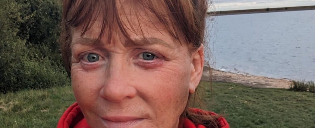 Mujer-queda-incapaz-de-cerrar-los-ojos-tras-cirugia-estetica-fallida-intriper.jpg