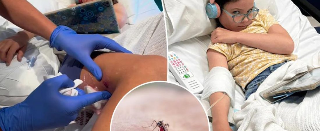Nino-pierde-movilidad-tras-rascar-picadura-de-mosquito-infectada-intriper.jpg