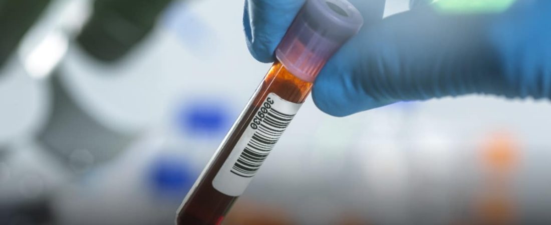 Prueba-de-sangre-detectara-12-tipos-de-cancer-temprano-en-Reino-Unido-intriper.jpg