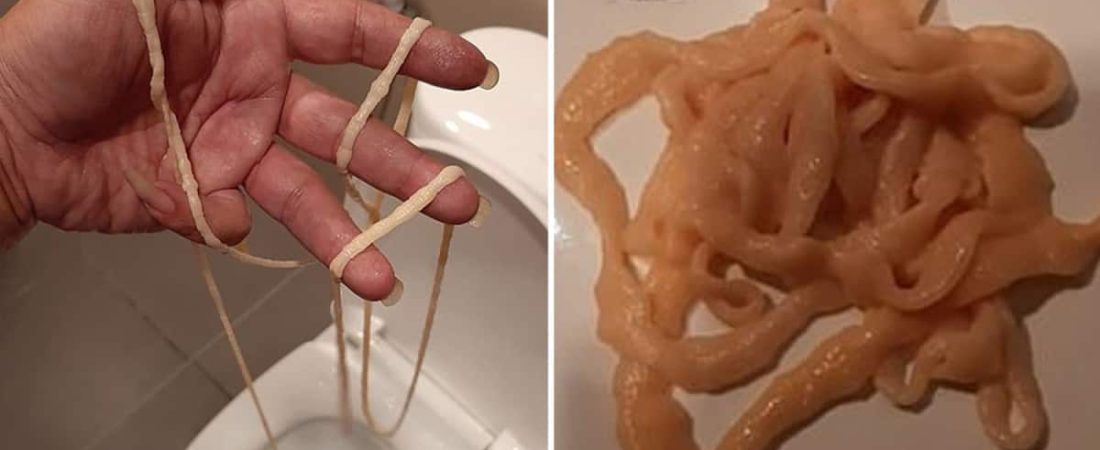 Thai-man-horrified-after-pulling-a-giant-moving-tapeworm-out