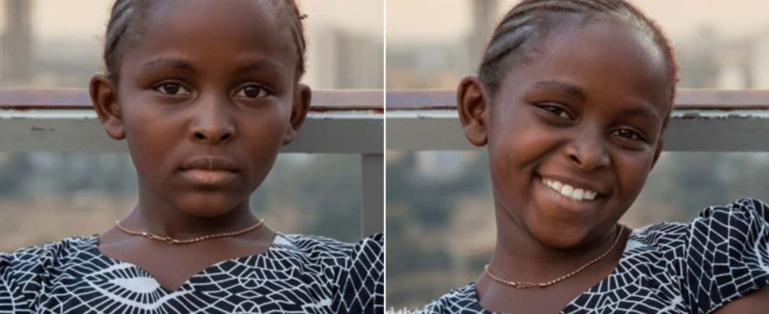 antes-y-después-efectos-de-una-sonrisa-en-las-personas