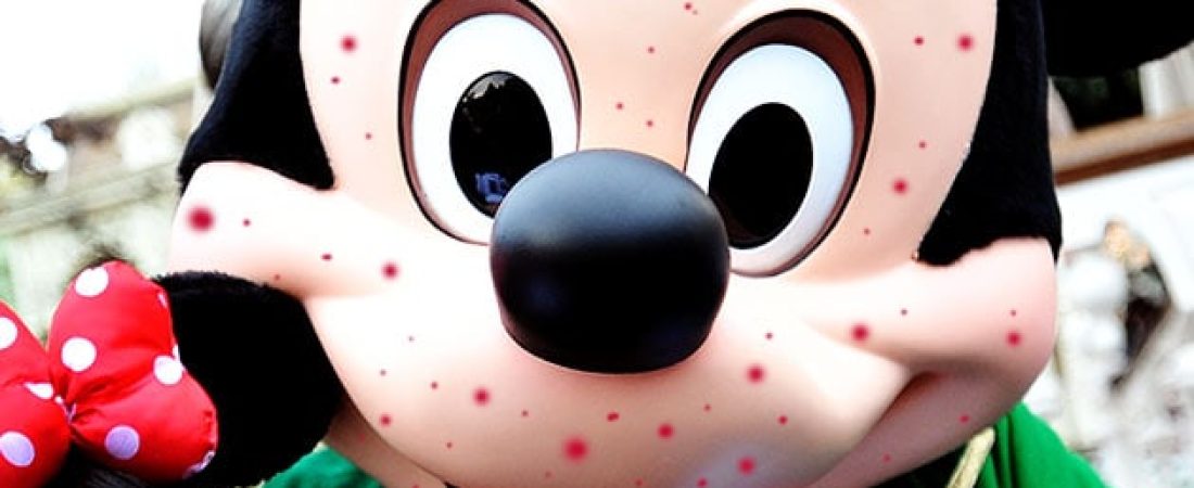 mickeymeasles